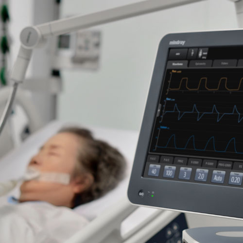 Patient on ventilator in ICU with vital signs monitor displaying respiratory data – advanced critical care equipment in use