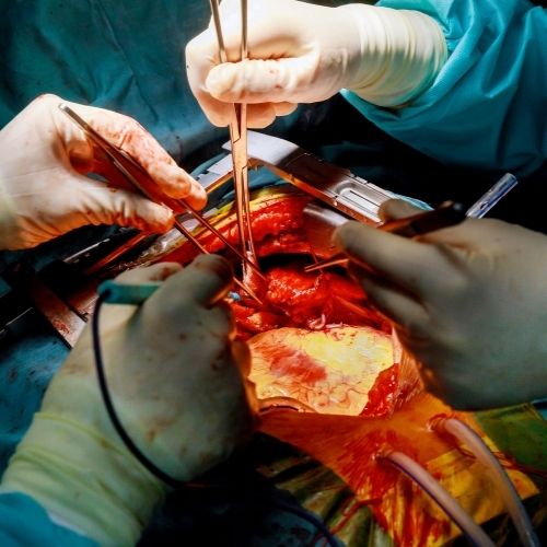 Urology Procedure