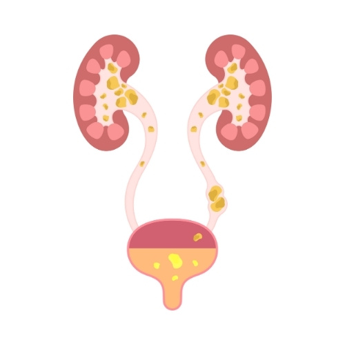 Urology Procedure