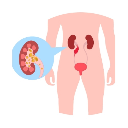 Urology Services