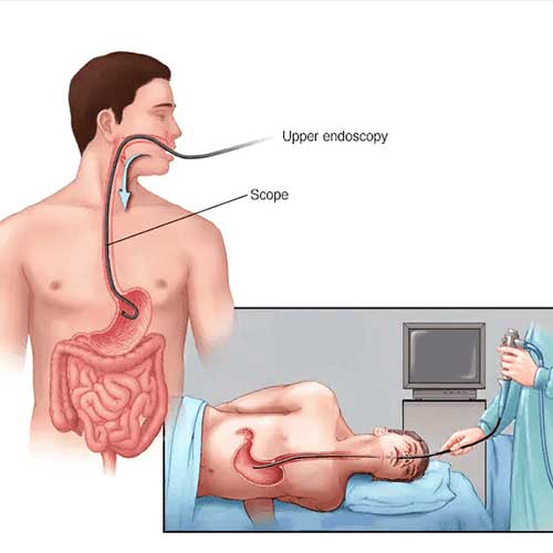 A digital illustration of a fetus inside a womb, with three medical instruments gently accessing the amniotic fluid.