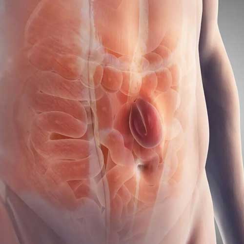 3D illustration of a human torso focusing on the abdomen, highlighting internal organs with a red emphasis on the intestines.