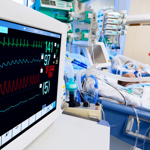 Patient on ventilator in ICU with vital signs monitor displaying respiratory data – advanced critical care equipment in use