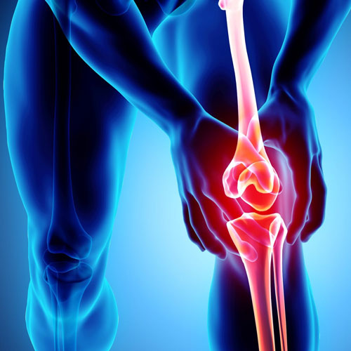 An anatomical illustration of a human leg highlighting the knee joint, with a focus on inflammation illuminated in red.