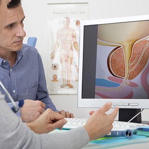 Two individuals discuss a digital medical illustration of the male reproductive system displayed on a computer screen.