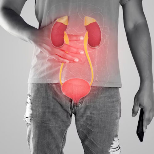 A man holds his abdomen, with highlighted kidneys, ureters, and bladder, symbolizing the urinary system.