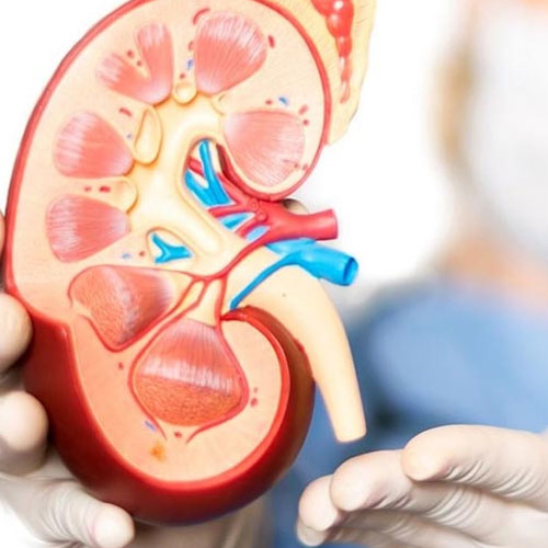 A healthcare professional holds a detailed anatomical model of a kidney, showcasing its internal structures and blood vessels.