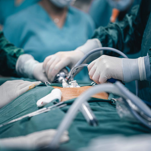 Surgeons perform a medical procedure on a patient in an operating room, using surgical instruments while wearing gloves and scrubs.
