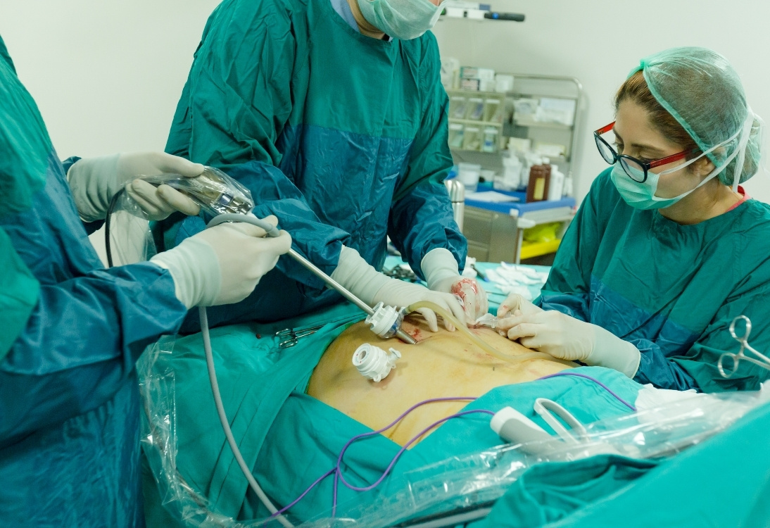 Surgery department available in minaai multispeciality hospital